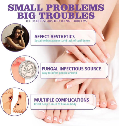 Extra Strong Nail Fungus Spray
