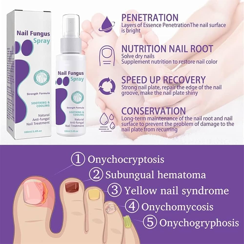 Extra Strong Nail Fungus Spray